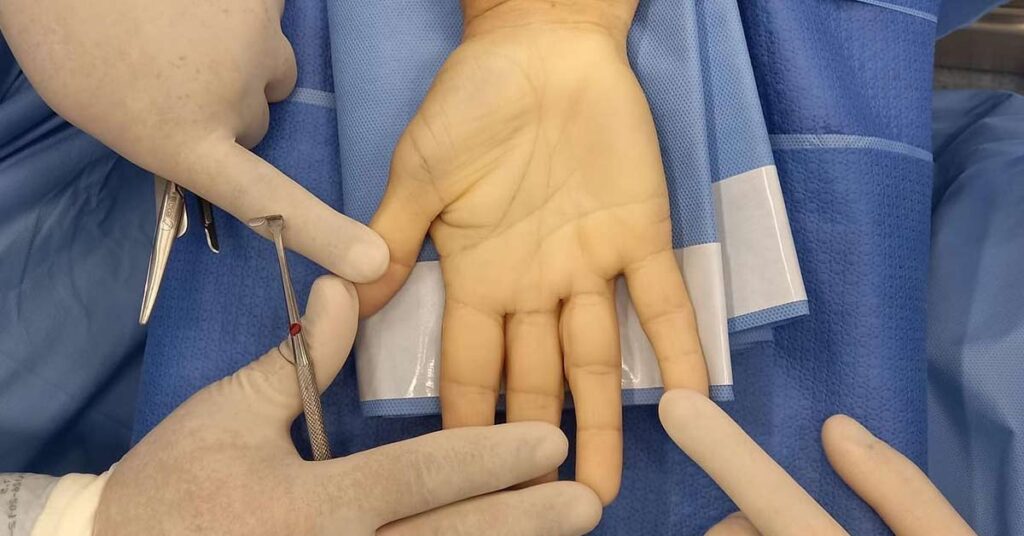A imagem atual não possui texto alternativo. O nome do arquivo é: 4-PAGINA-Cirurgia-de-mao.jpg